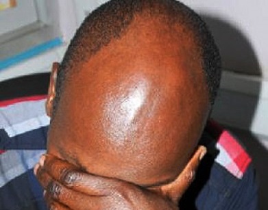 Bald people could be targets of ritual killings – Mozambique police