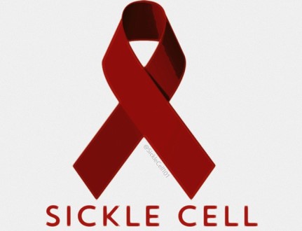 Living with sickle cell; the untold story [Audio]