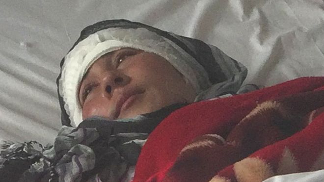 Afghan woman’s ears cut off by husband
