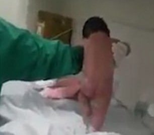 Brazil: New-born baby walks immediately after his birth