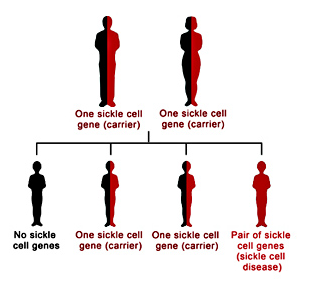 sickle-cell-1