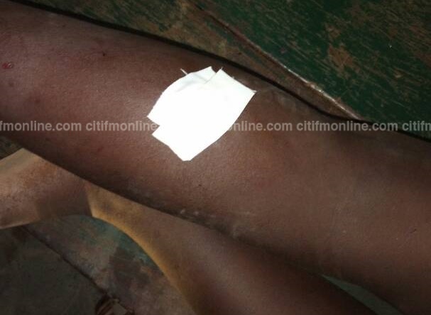 5 injured in shooting at NPP Chairman’s house in Akyem-Akroso