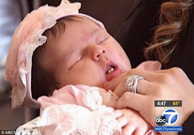 Missouri baby born with two front teeth!