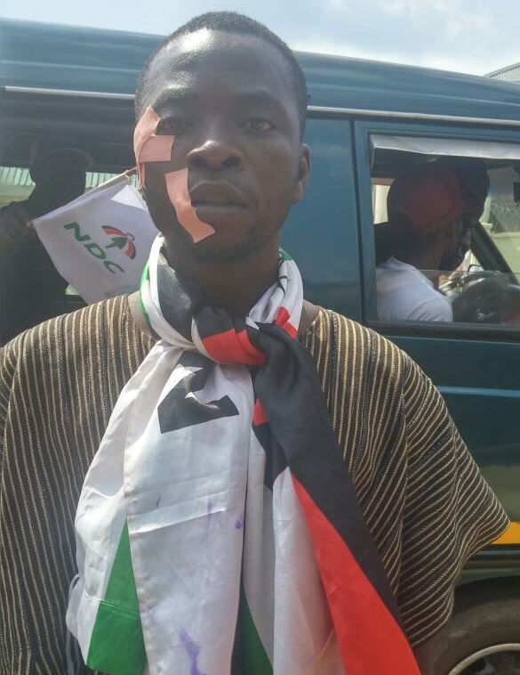 A member of the NDC injured as a result of the confusion.