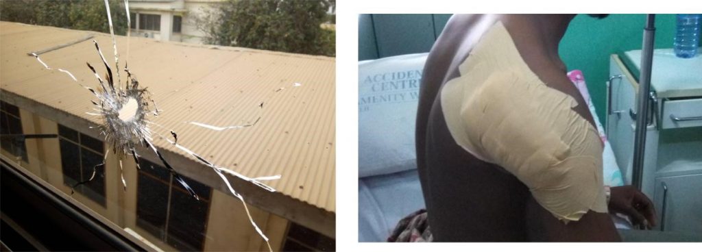 Figure: Pictures from the glass through which the bullet entered the office in the central laboratory of Korle Bu. Also, a picture of the scientist with dressed wound on the shoulder in the ward of the hospital